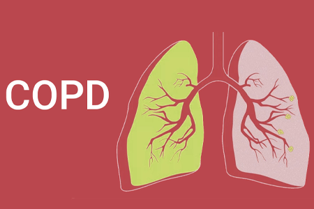 COPD for Govt Officials